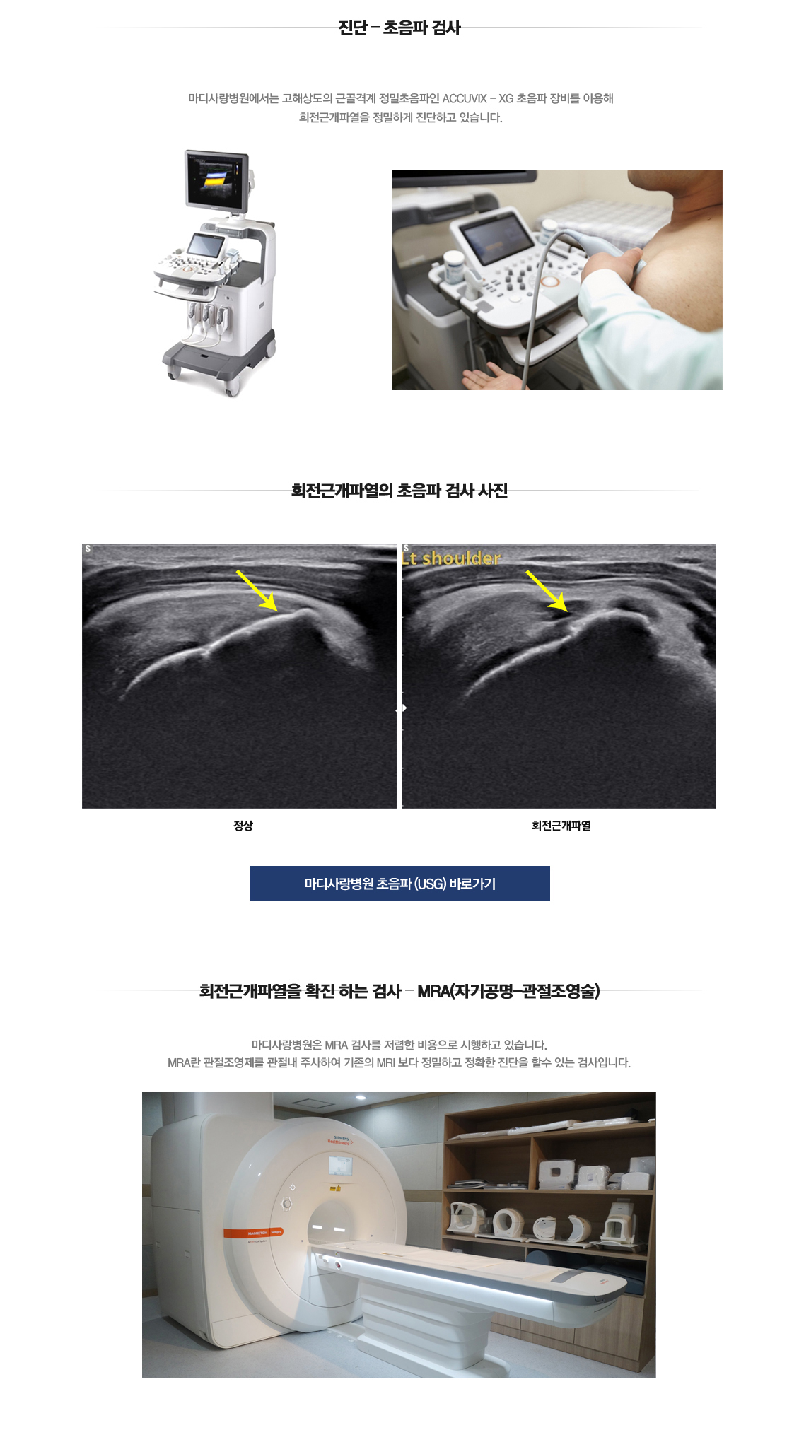 회전근개파열