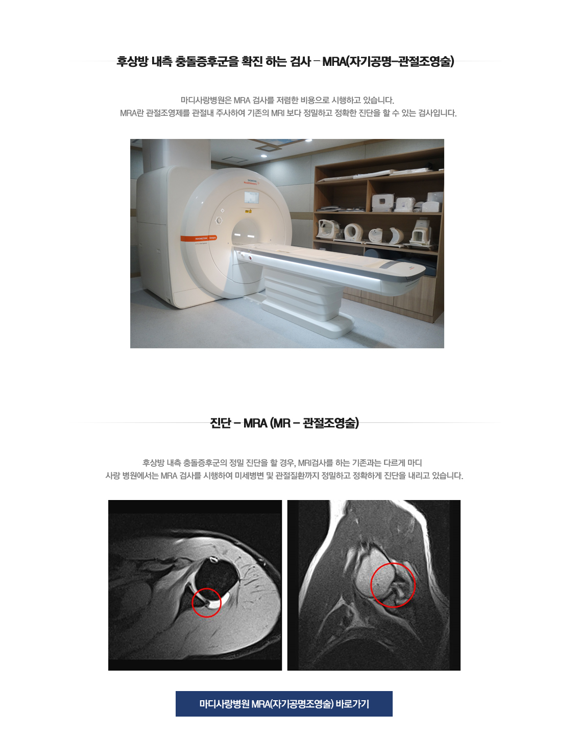 후상방내측충돌증후군