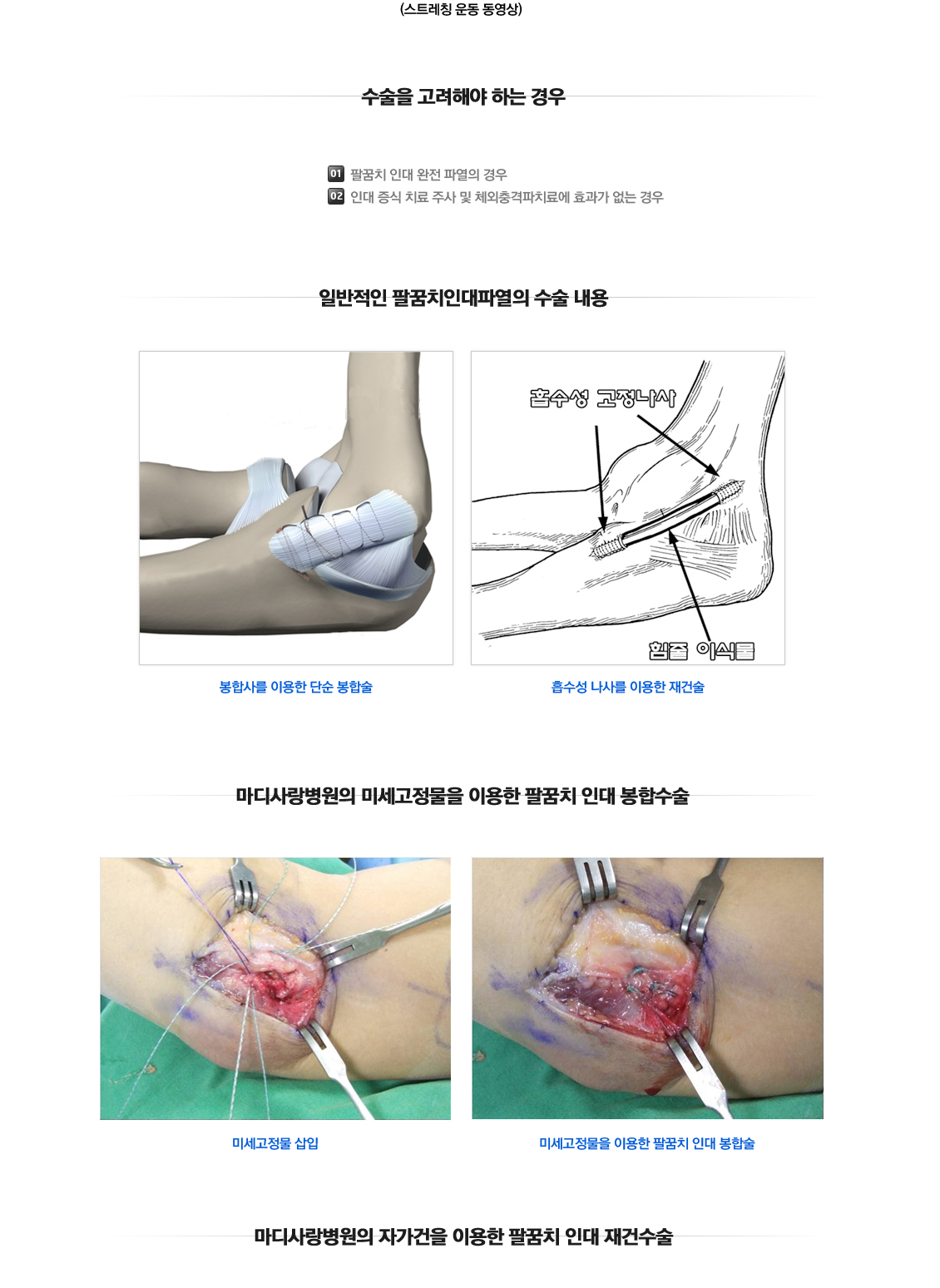 팔꿈치 증상별 진단 