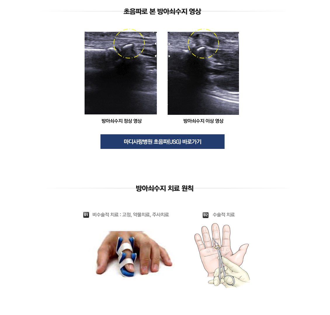 손목 증상별 진단 