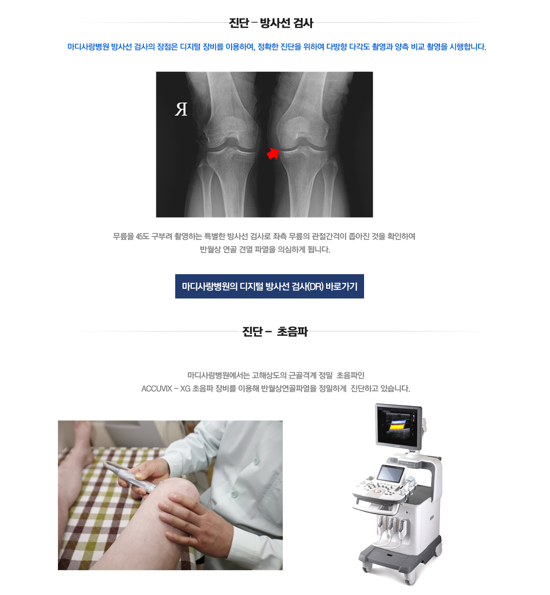 반월상연골 견열파열