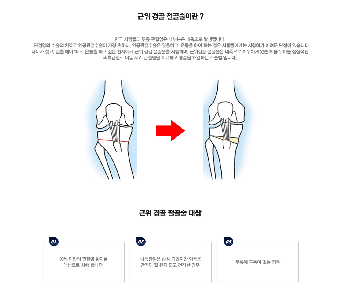 퇴행성관절염