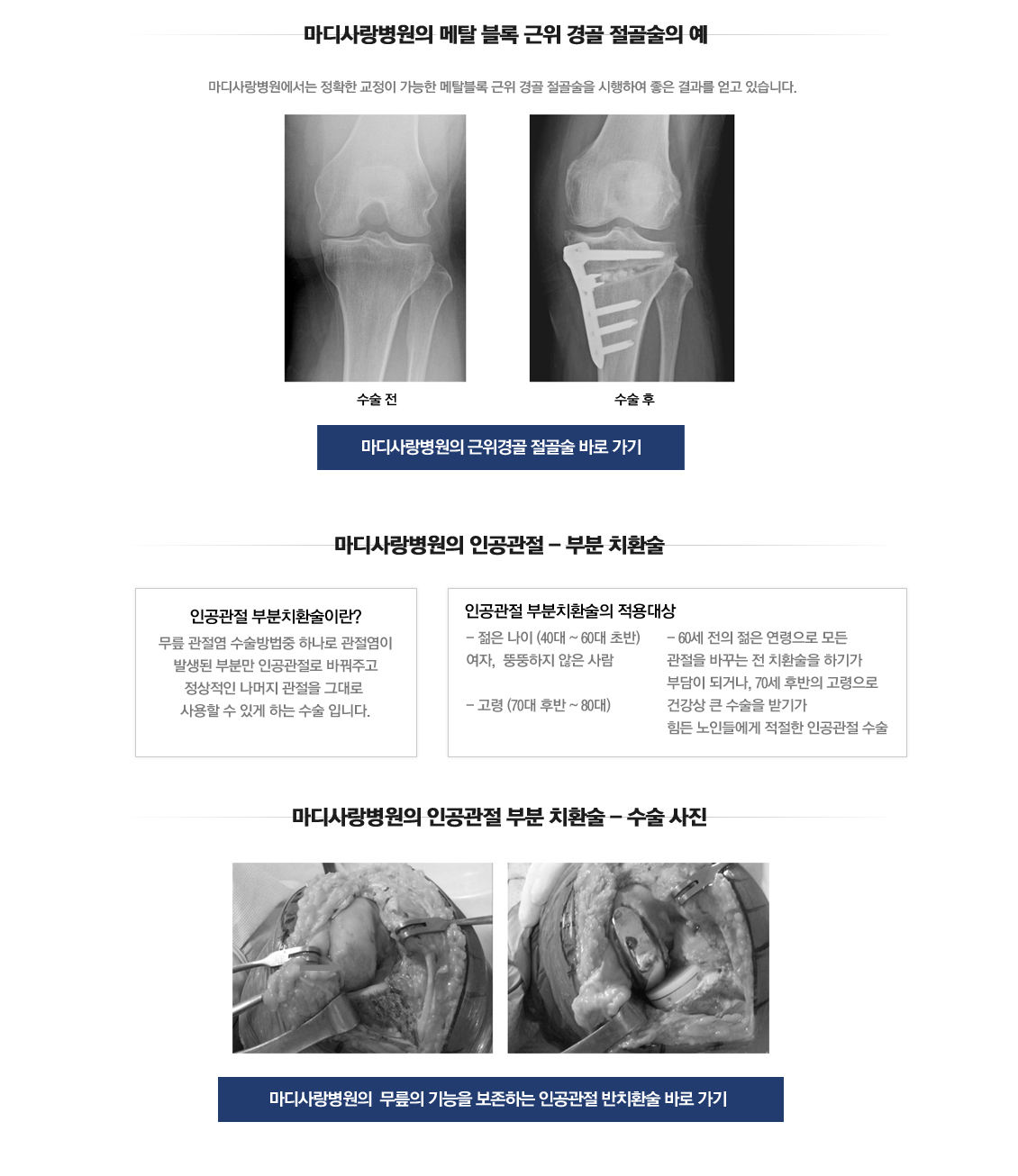 퇴행성관절염