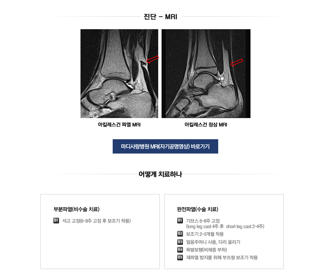 아킬레스건 손상 및 파열