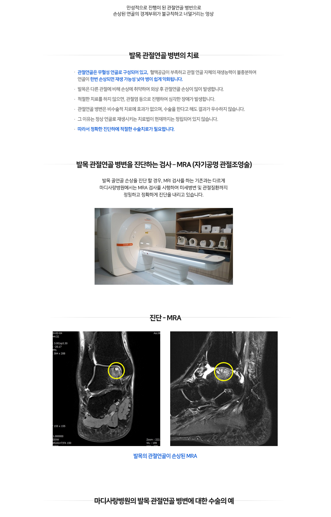 발목 증상별 진단