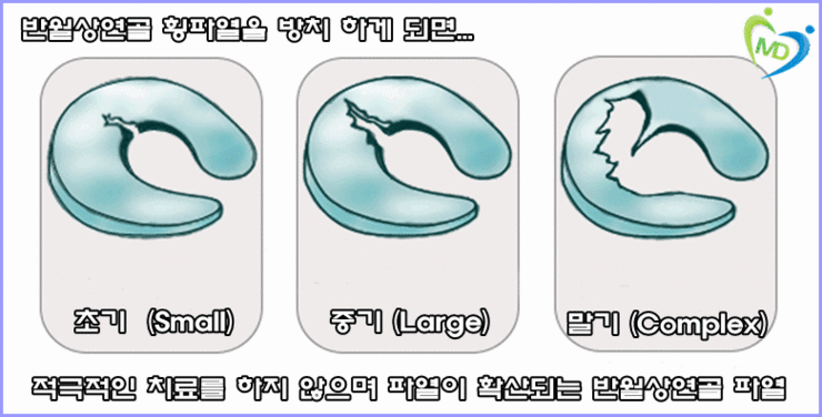 마디사랑병원 - 커뮤니티 > 마디사랑병원블로그