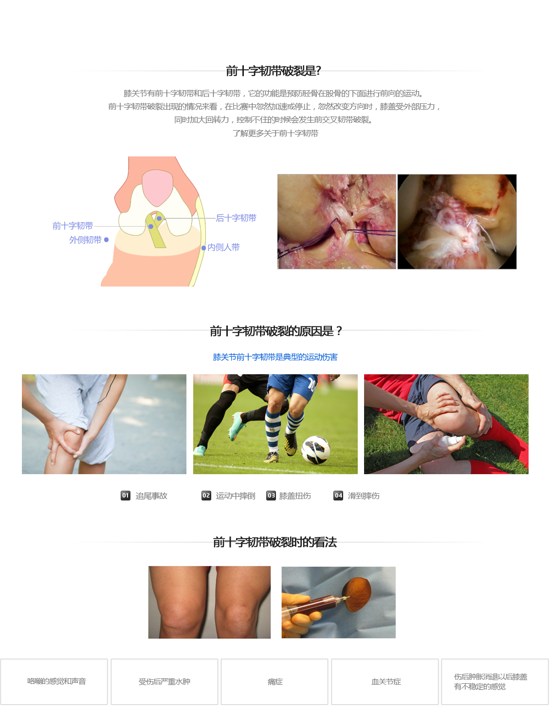 전방십자인대 파열