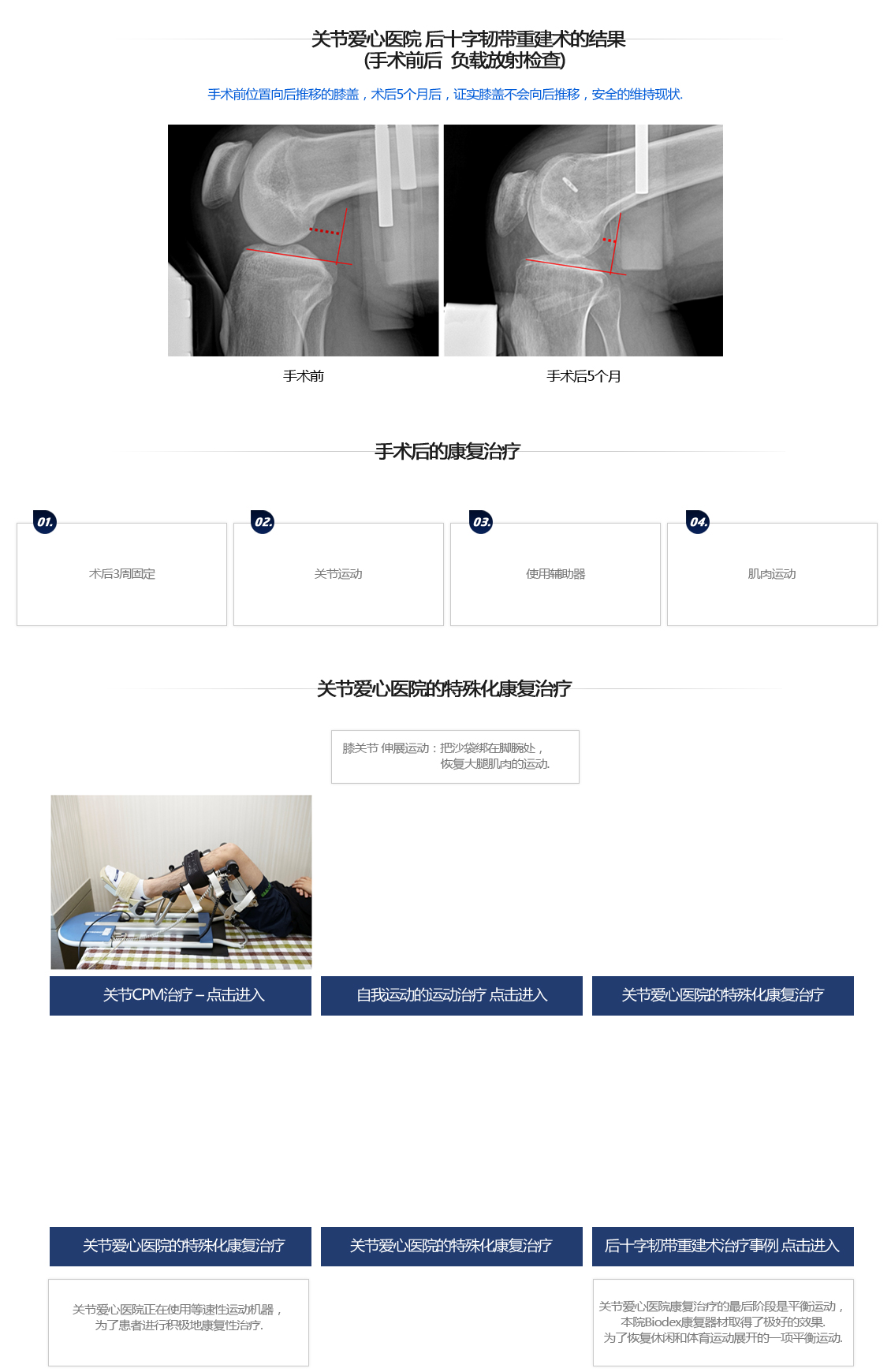 후방십자인대 파열