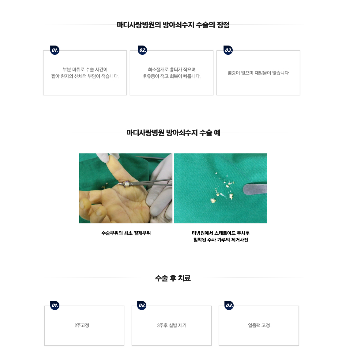 방아쇠수지