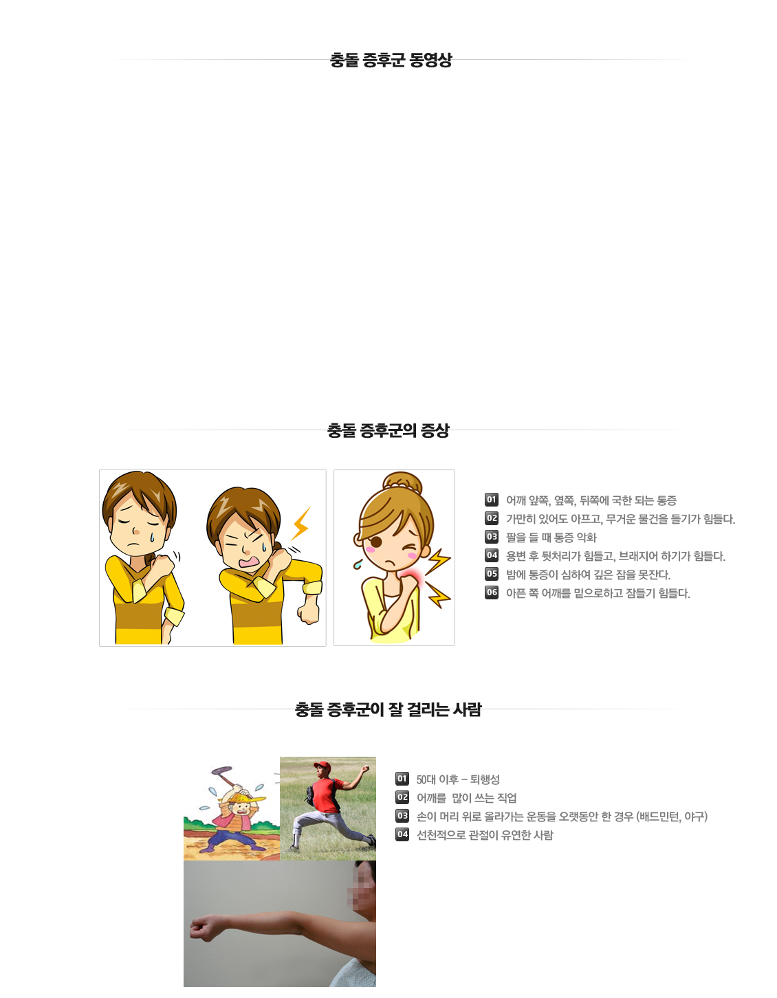 Impingement syndrome 