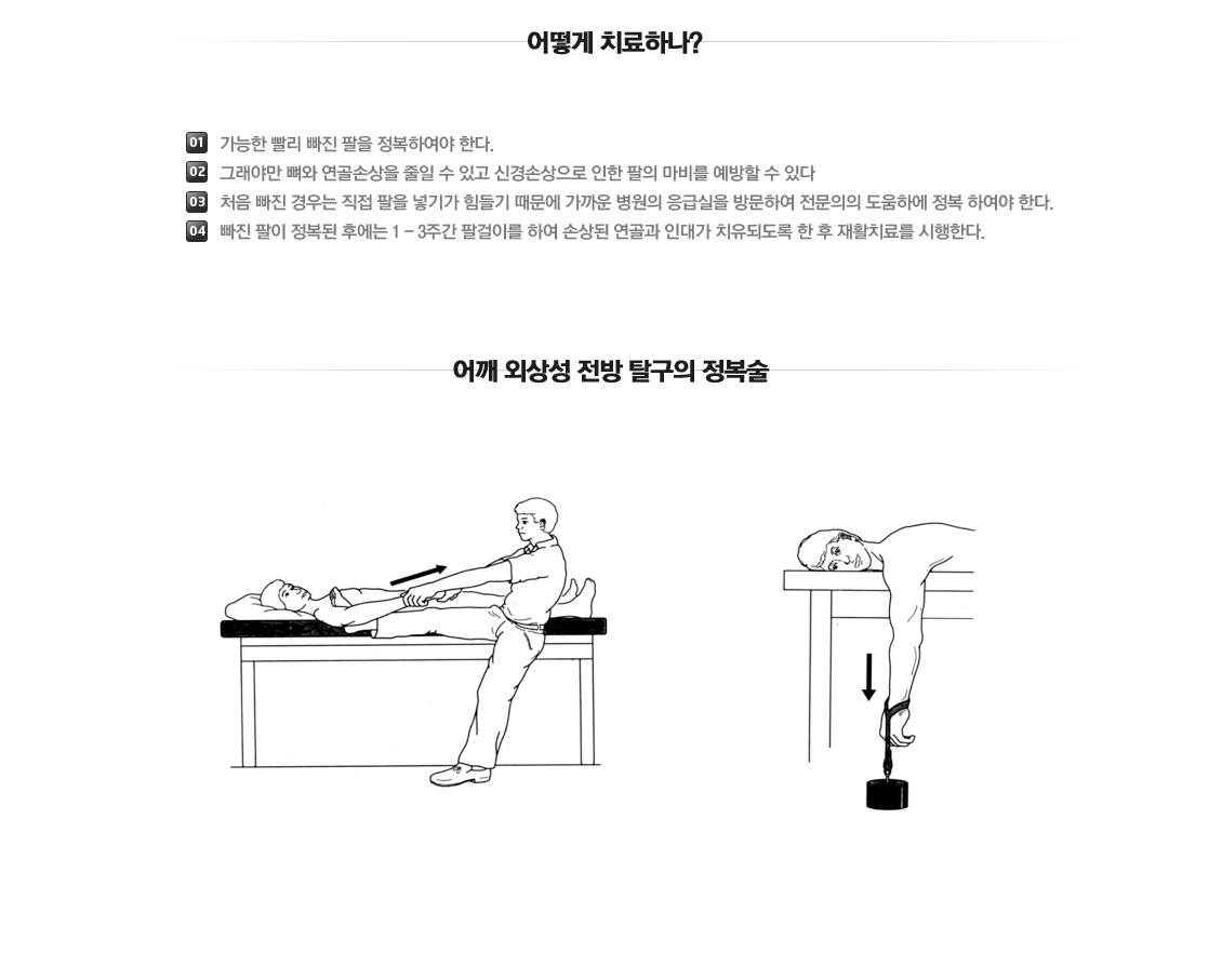 Traumatic dislocation