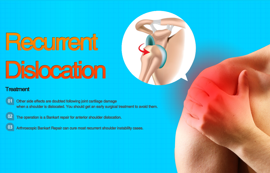 Recurrent dislocation