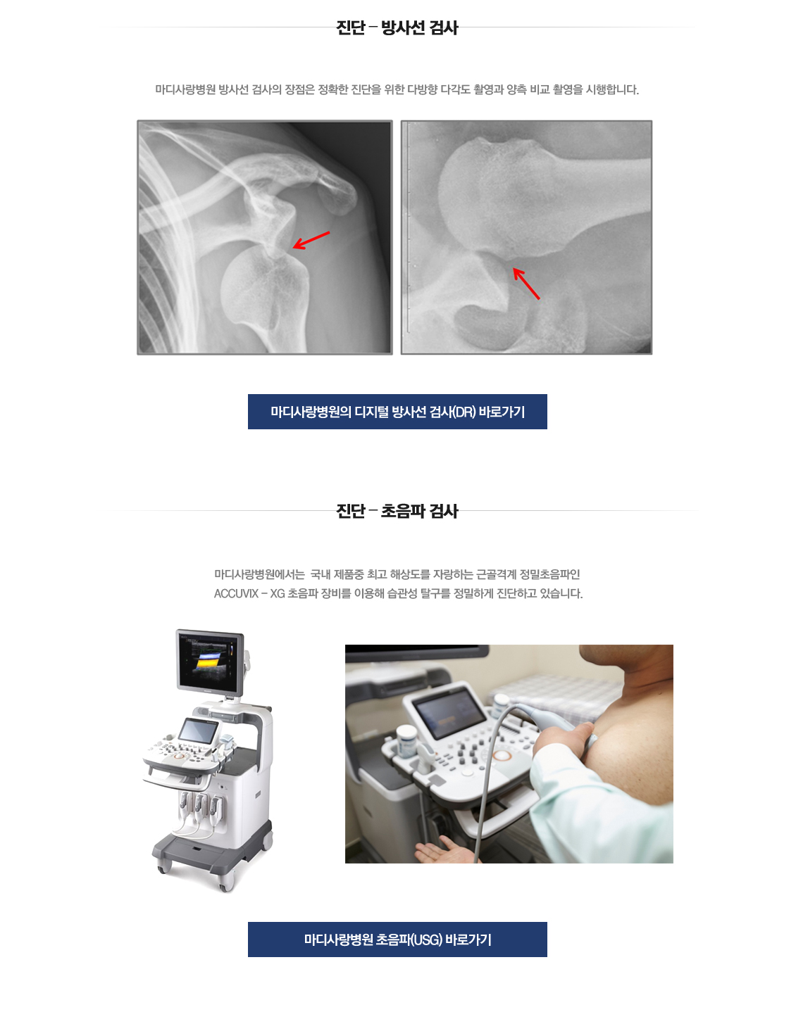 Recurrent dislocation