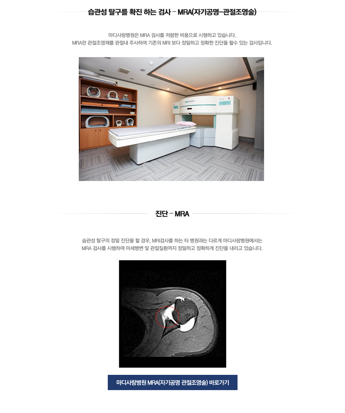 Recurrent dislocation