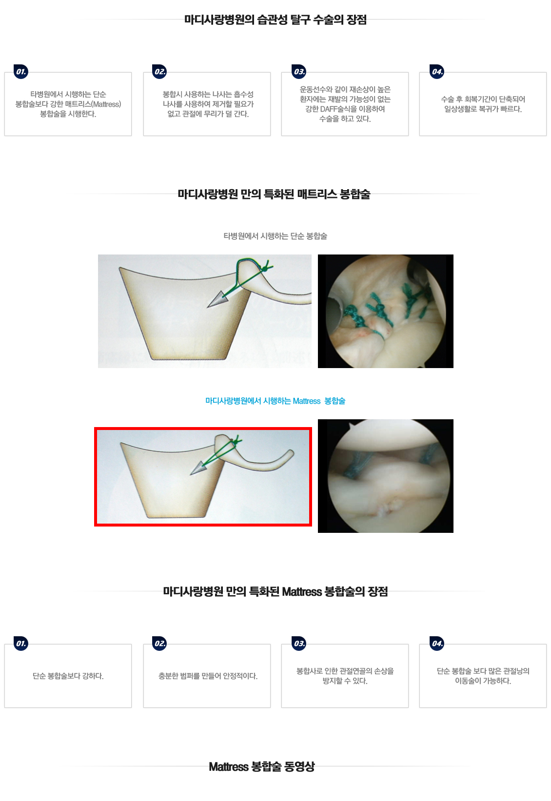 Recurrent dislocation