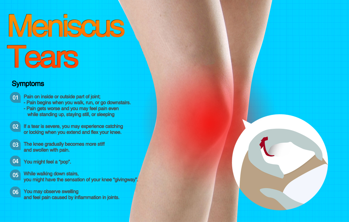 Meniscus Tears
