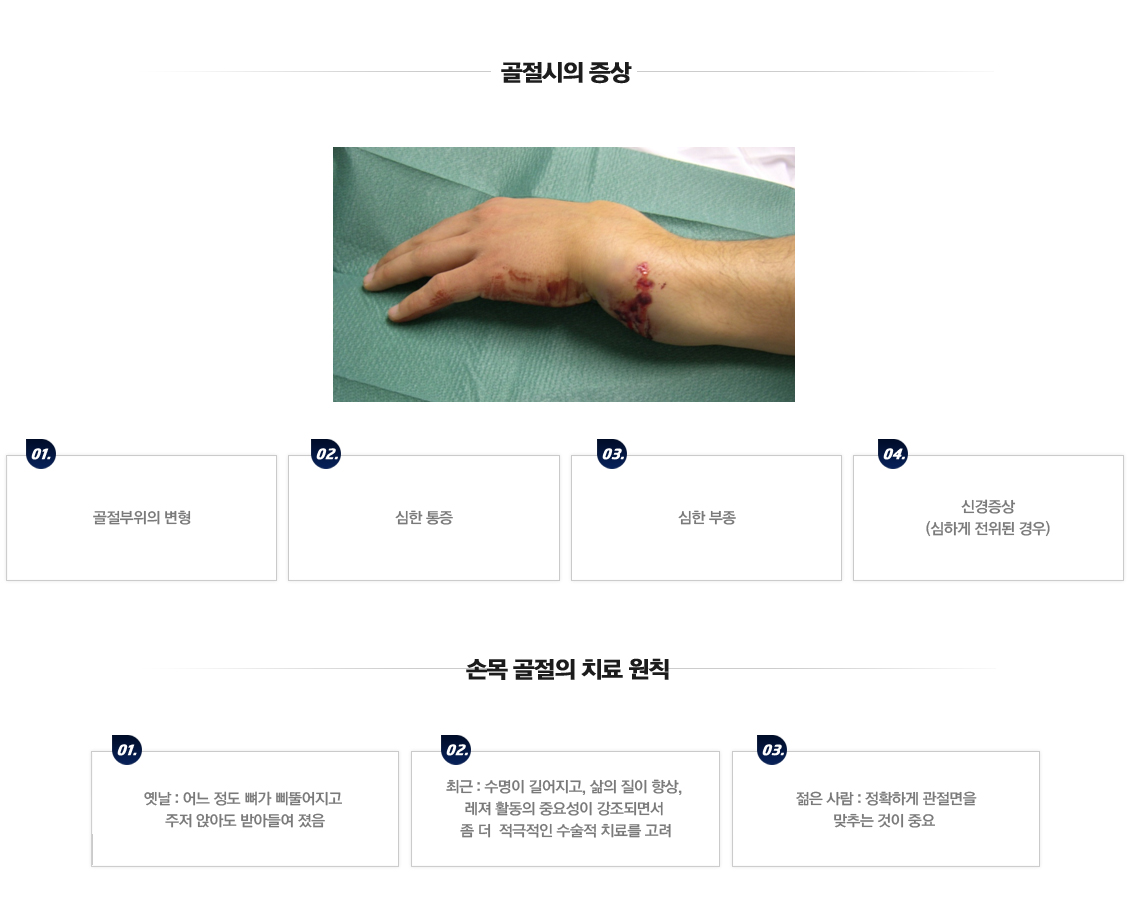 Fracture in Children