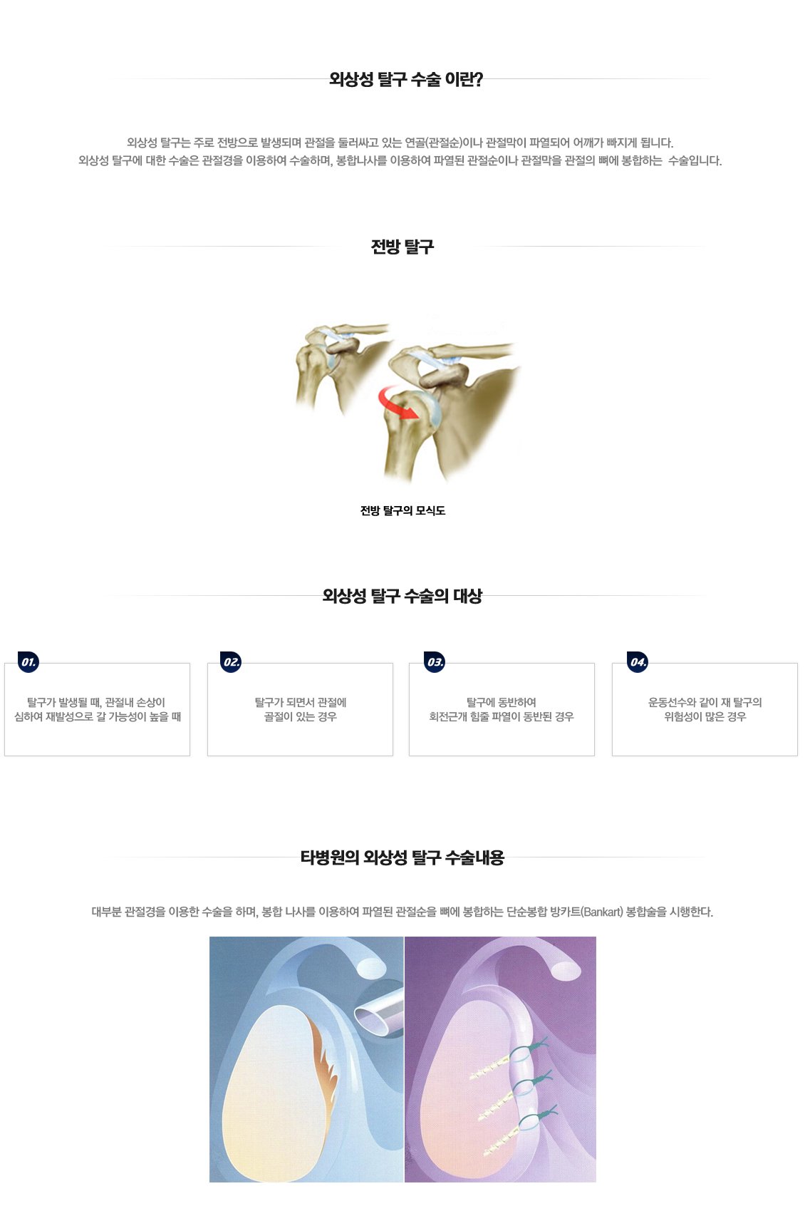 Traumatic Dislocation