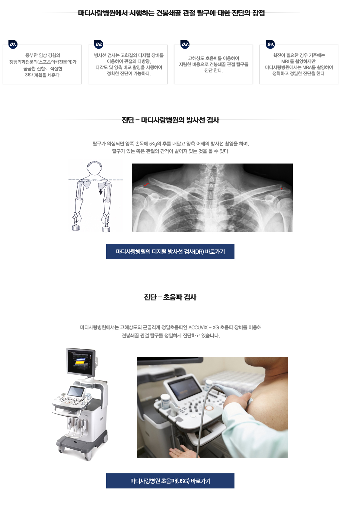 견봉쇄골 관절 탈구