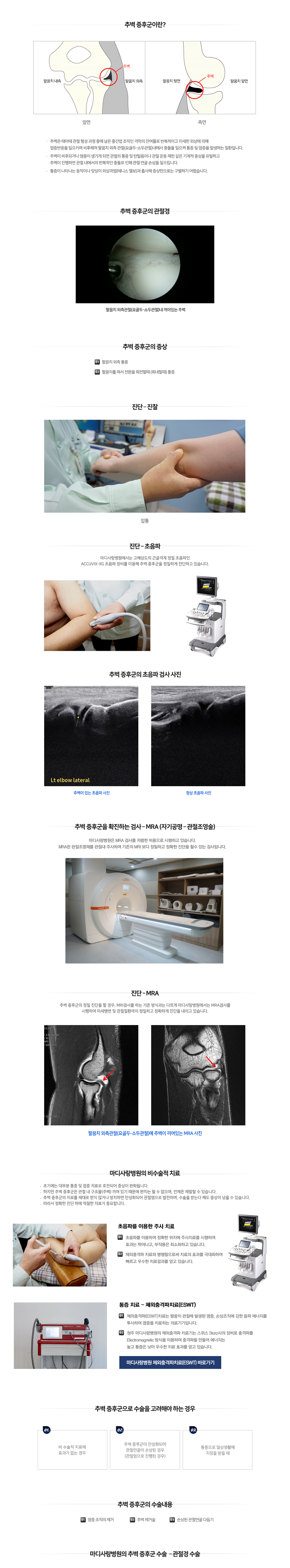 팔꿈치 증상별 진단