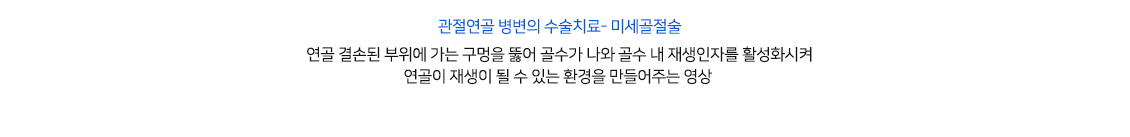 발목 증상별 진단