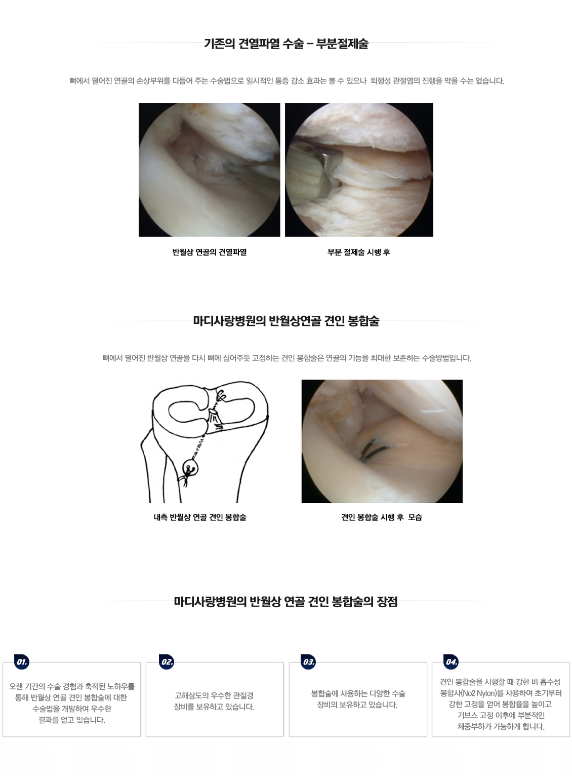 어깨 골절수술